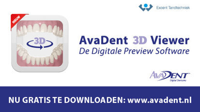 AvaDent 3D Viewer: Digitale Preview Software