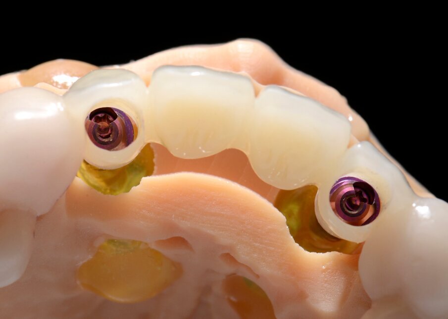 Fig. 48 - Visione occlusale.