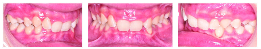 Fig. 7a. Patient S. V. pre-treatment. 