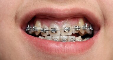 Tandartstarieven in 2013 omlaag