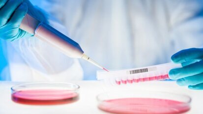 Nieuw testmodel voor cariëspreventie