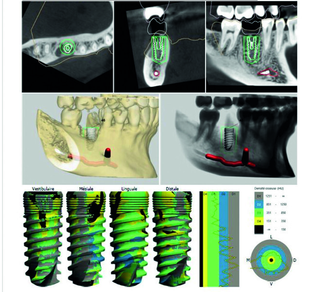 Fig. 5 : Rapport chirurgical.