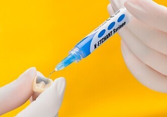 K-ETCHANT Syringe (GRC) K-ETCHANT Syringe (GRC)