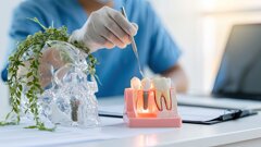 “Understanding patterns of peri-implant bacterial colonisation is fundamental to preventing progression to peri-implant mucositis”