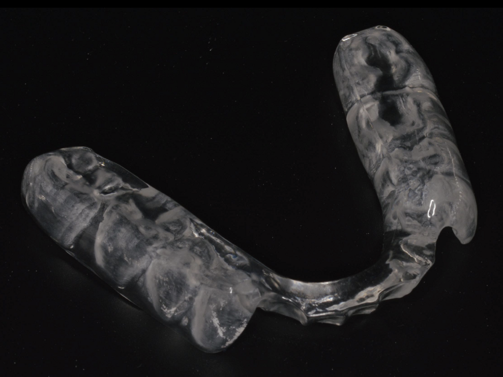 Fig. 11: Posterior splint.