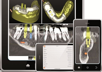 Faster and transparent SurgiGuide service leads to a better user experience