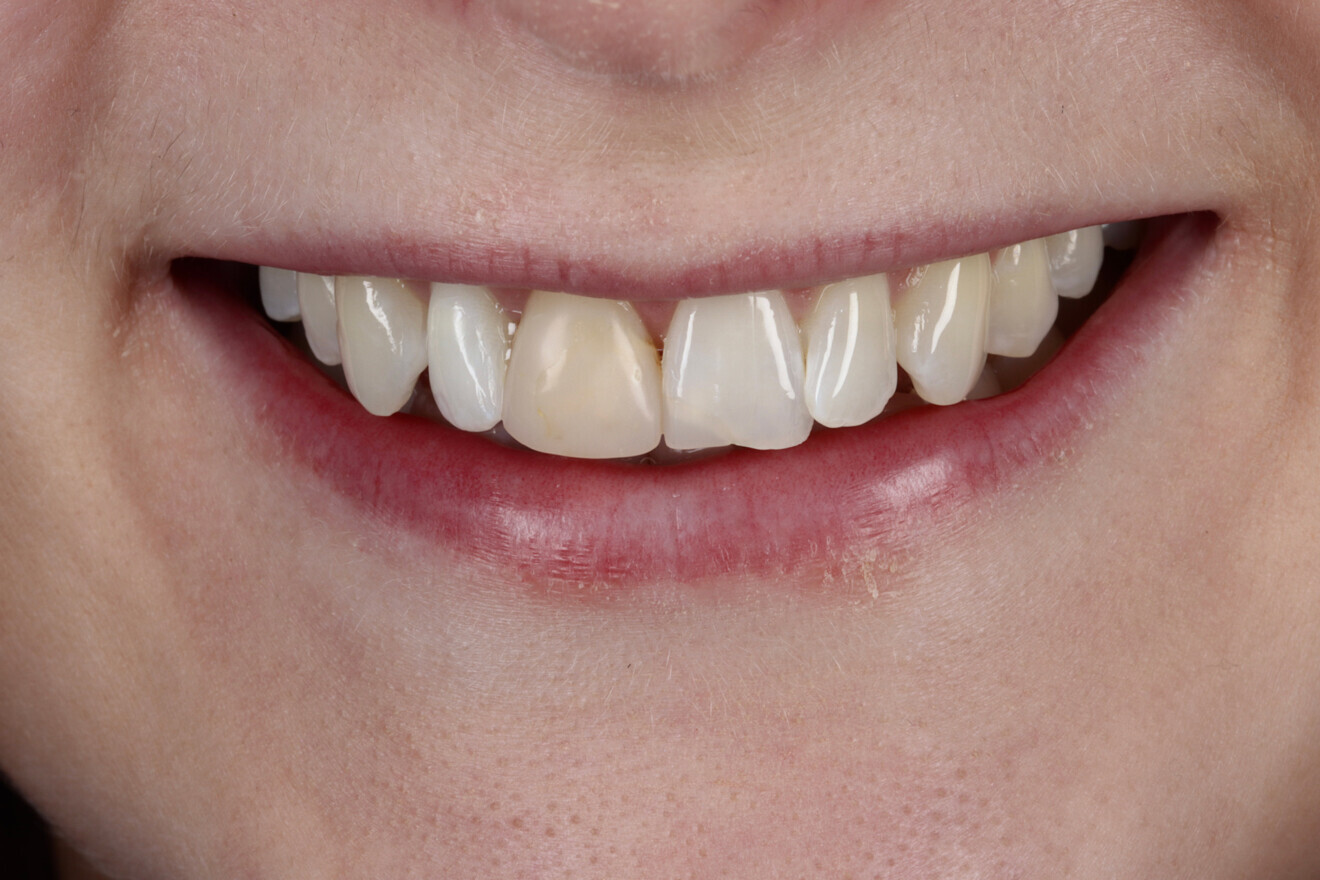 Patient during treatment. (Image: Freshdental) 