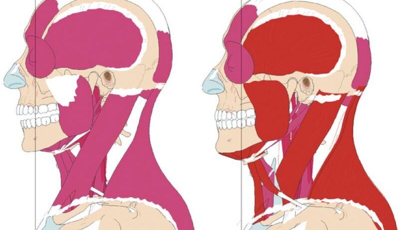 Posturologie et dentisterie: une correspondance possible?
