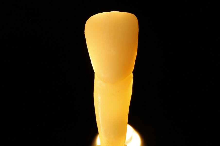 Fig. 12g: Light dynamics of natural teeth in direct and indirect light.