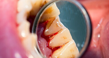 Is it time to re-unite the mouth with the rest of the body?