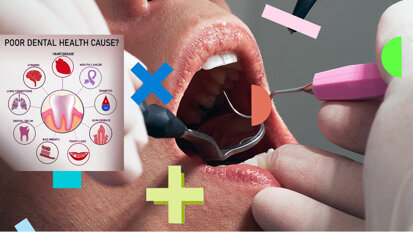 Oral ailments may affect cognitive health, warn experts