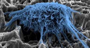 Dalla ricerca un nuovo rivestimento per prevenire le infezioni agli impianti dentali