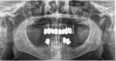 Contenzioso? No grazie! Come evitare in poche mosse rotte di collisione col paziente