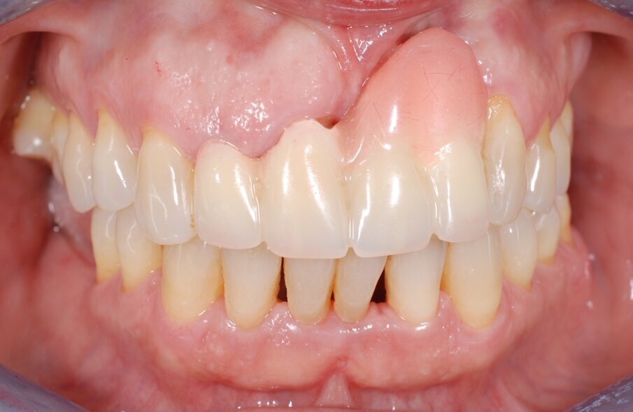 Fig. 1 - Situazione clinica iniziale.