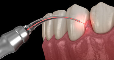 BIOLASE Academy brings dental laser education online