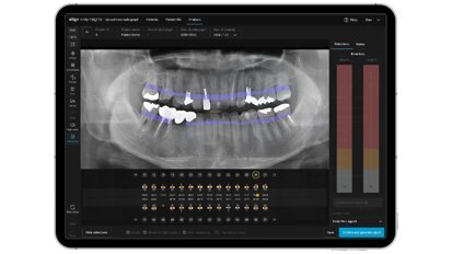 Align Technology lancia in Europa e Regno Unito Align X-ray Insights, un software di rilevamento computerizzato supportato dall’intelligenza artificiale