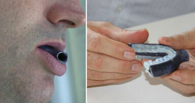 Apnea notturna: il nuovo boccaglio stampato in 3D può aiutare migliaia di pazienti