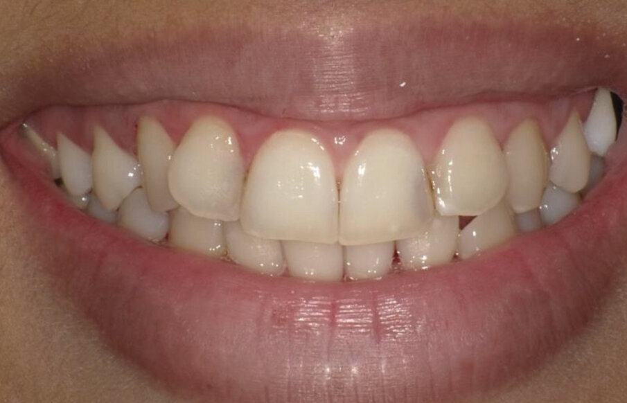 Fig. 9: Initial situation.