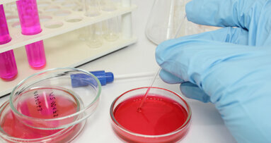 Forscher finden Ursache für Biofilm-Entstehung