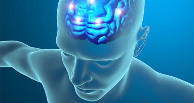 Neuartiges Mini-Implantat gegen chronische Kopfschmerzen