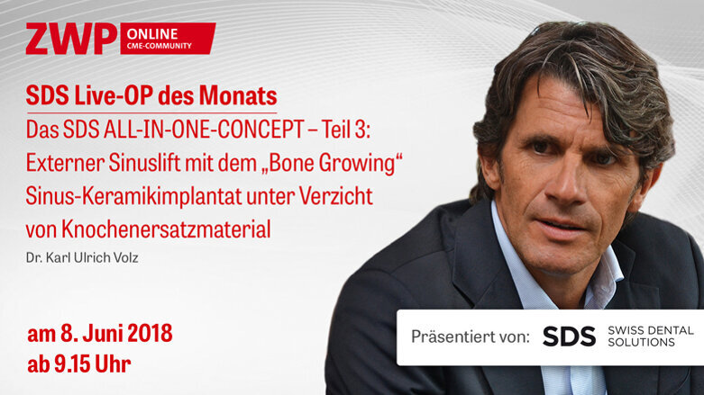 Live-OP am 8. Juni : Das SDS ALL-IN-ONE-CONCEPT – Teil 3