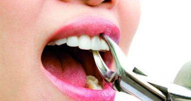 无执照牙医困扰斐济