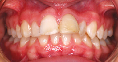 Muscling in on the truth