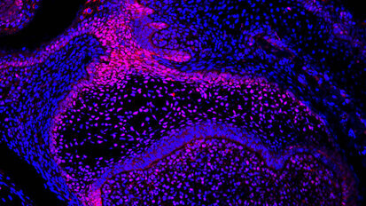 Researchers examine regenerative potential of mice teeth