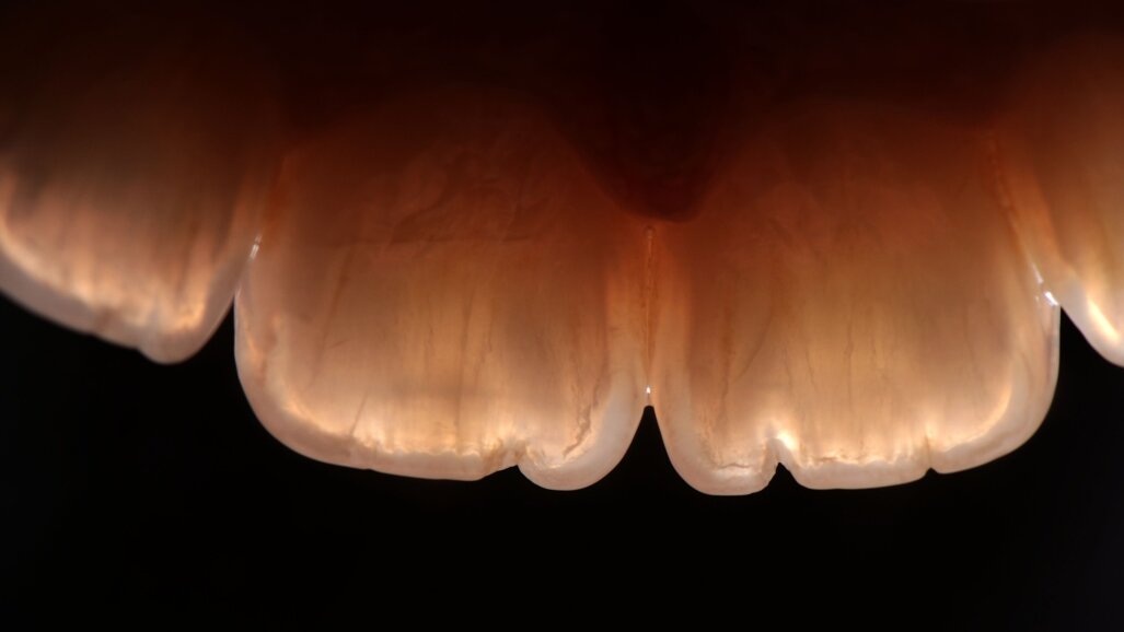 Een langetermijnvisie op korte vezels