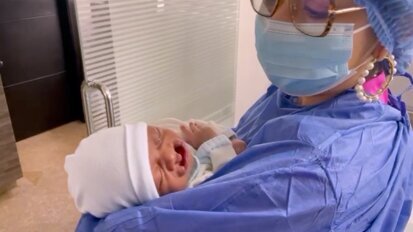 Labio y paladar fisurado Jesus video1