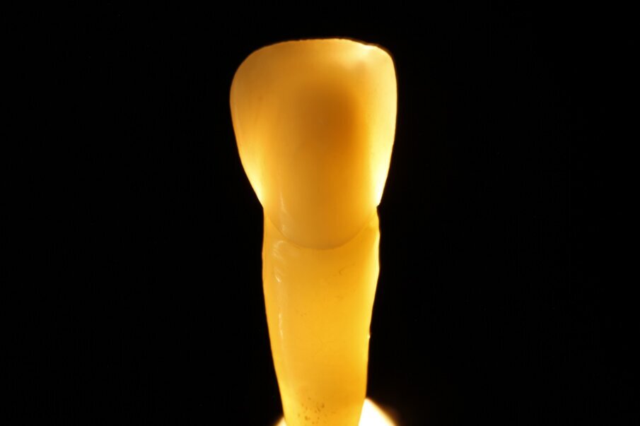 Fig. 12f: Light dynamics of natural teeth in direct and indirect light.