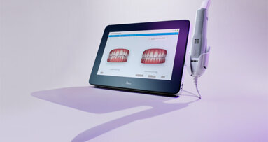 Společnost Align Technology uvádí na český a slovenský trh nový zobrazovací systém iTero Element 5D
