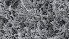 Projekt „MinOroBiome“ untersucht bakterielle Biofilme im Mund