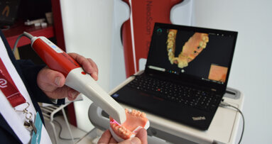 Neoss celebrates anniversary with NeoScan 1000