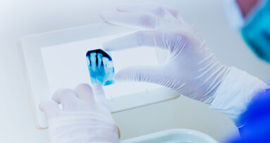 Dentistry reloaded: How will dentists treat Generations Z and Alpha? Dentistry reloaded: How will dentists treat Generations Z and Alpha?