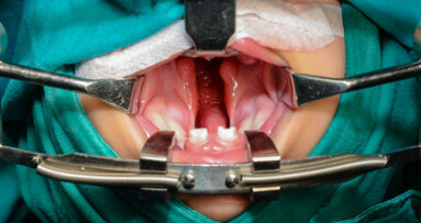 USC researchers seek to understand craniofacial abnormalities