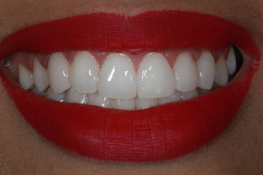 Fig. 10: Final outcome.