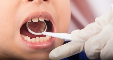 Estudo encontra alto nível de mercúrio em urina de crianças com amálgama nas obturações