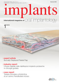 implants Italy No. 1, 2023