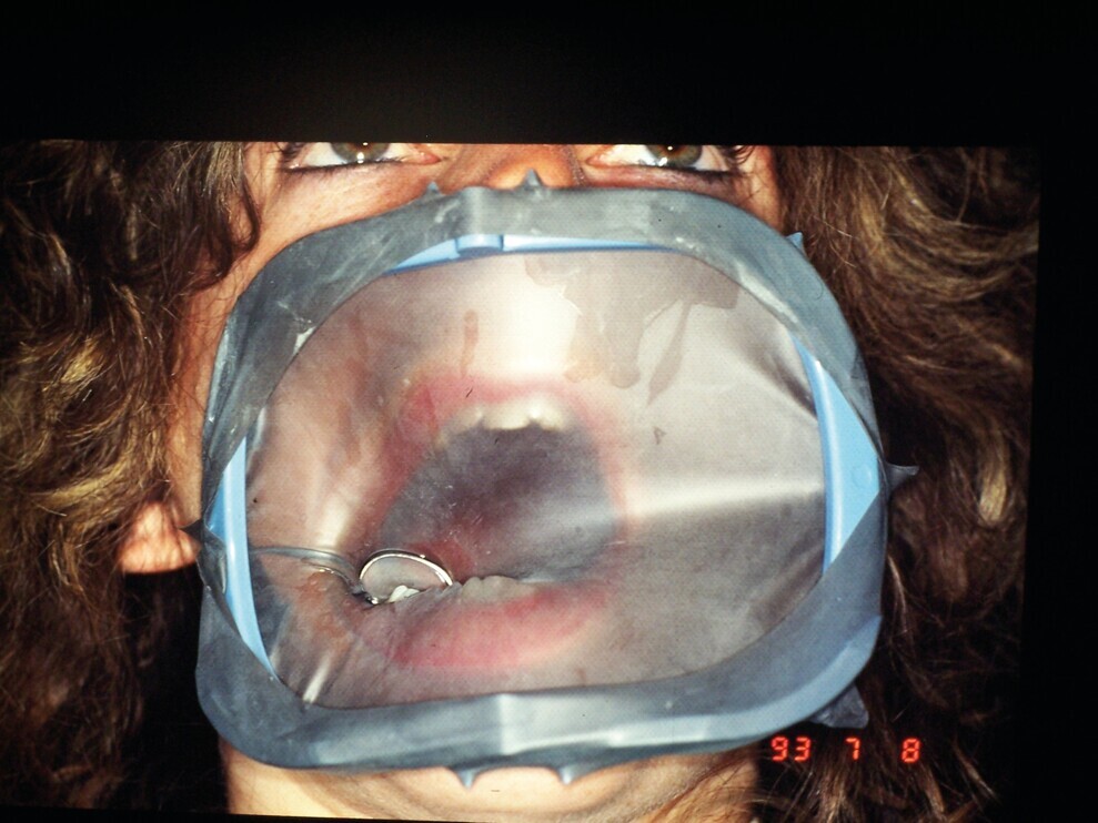 Fig. 6 : Le cadre articulé G SAUVEUR. 