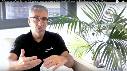 Los tips para restauraciones de August Bruguera