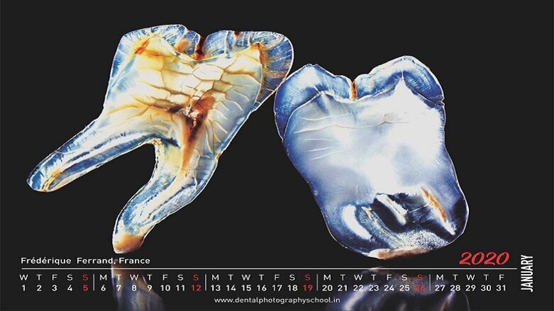 French dentist wins contest of Dental photography school's 2019 calendar