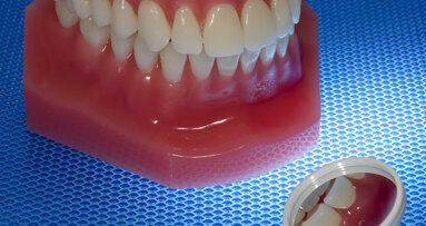 CDC: Half of American adults have periodontal disease