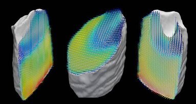 Nouvelle technologie d'imagerie pour visualiser les nanostructures des dents