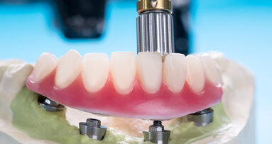 Trends in the US overdenture market