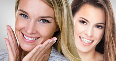 Иновативната технология Fastbraces ще бъде представена в София