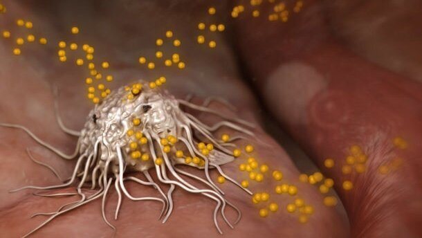 3D филм за остеоинтеграцията с премиера на „Европерио“