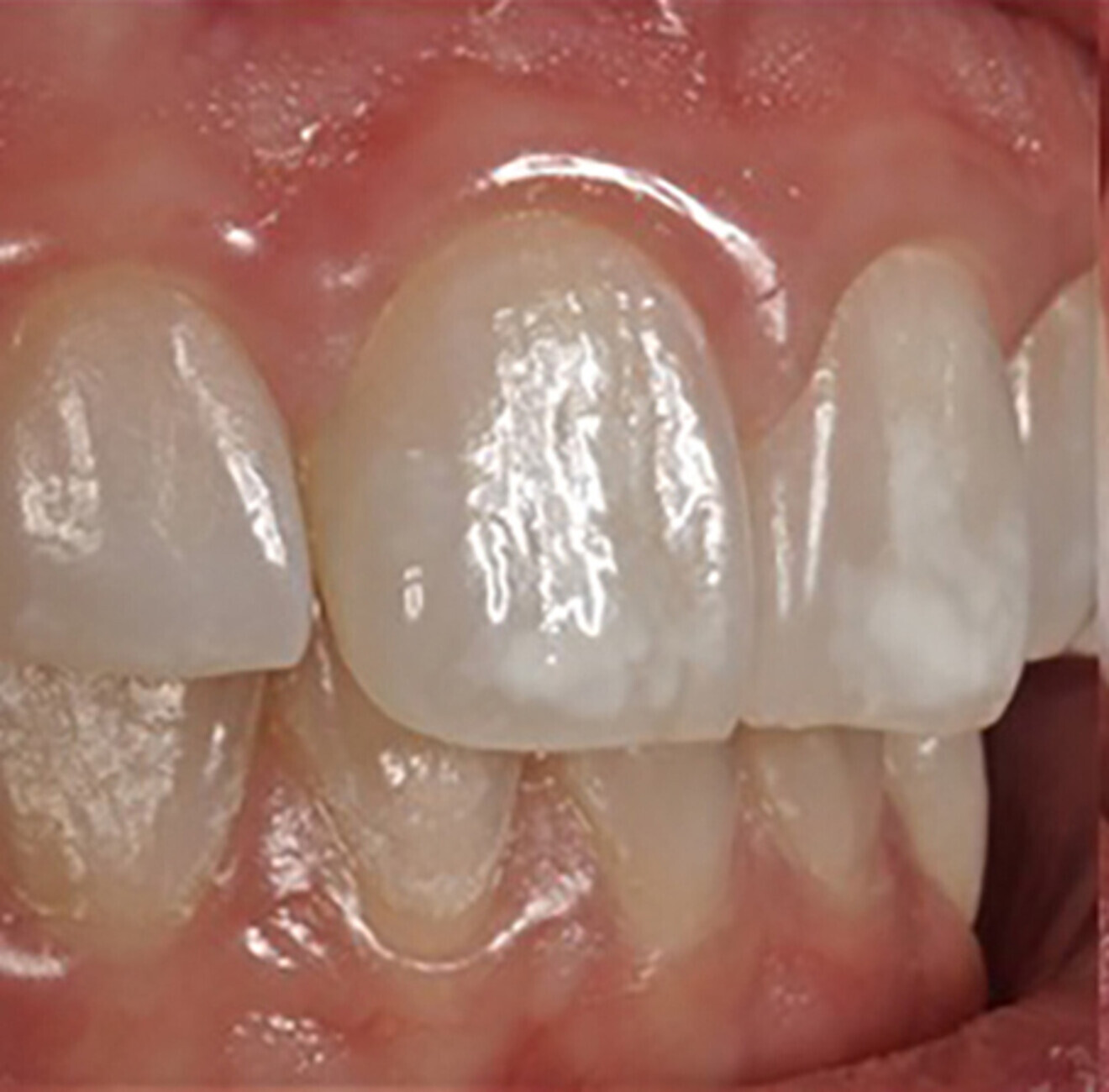 Fig. 2b: Right lateral view.