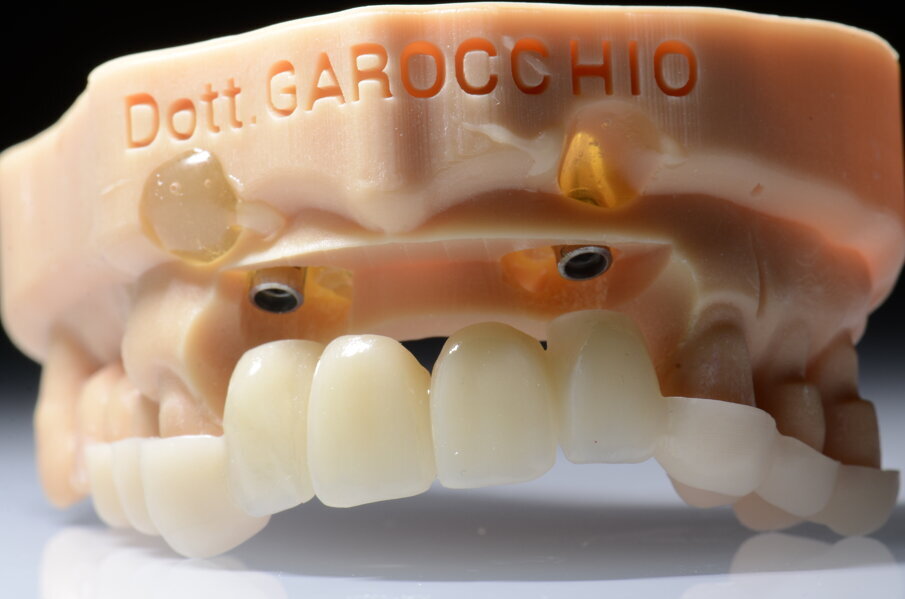 Fig. 45 - Provvisorio.