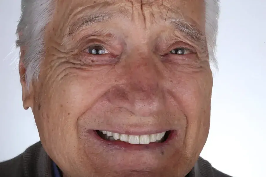 Фиг. 21: Едногодишно проследяване, лицев изглед.